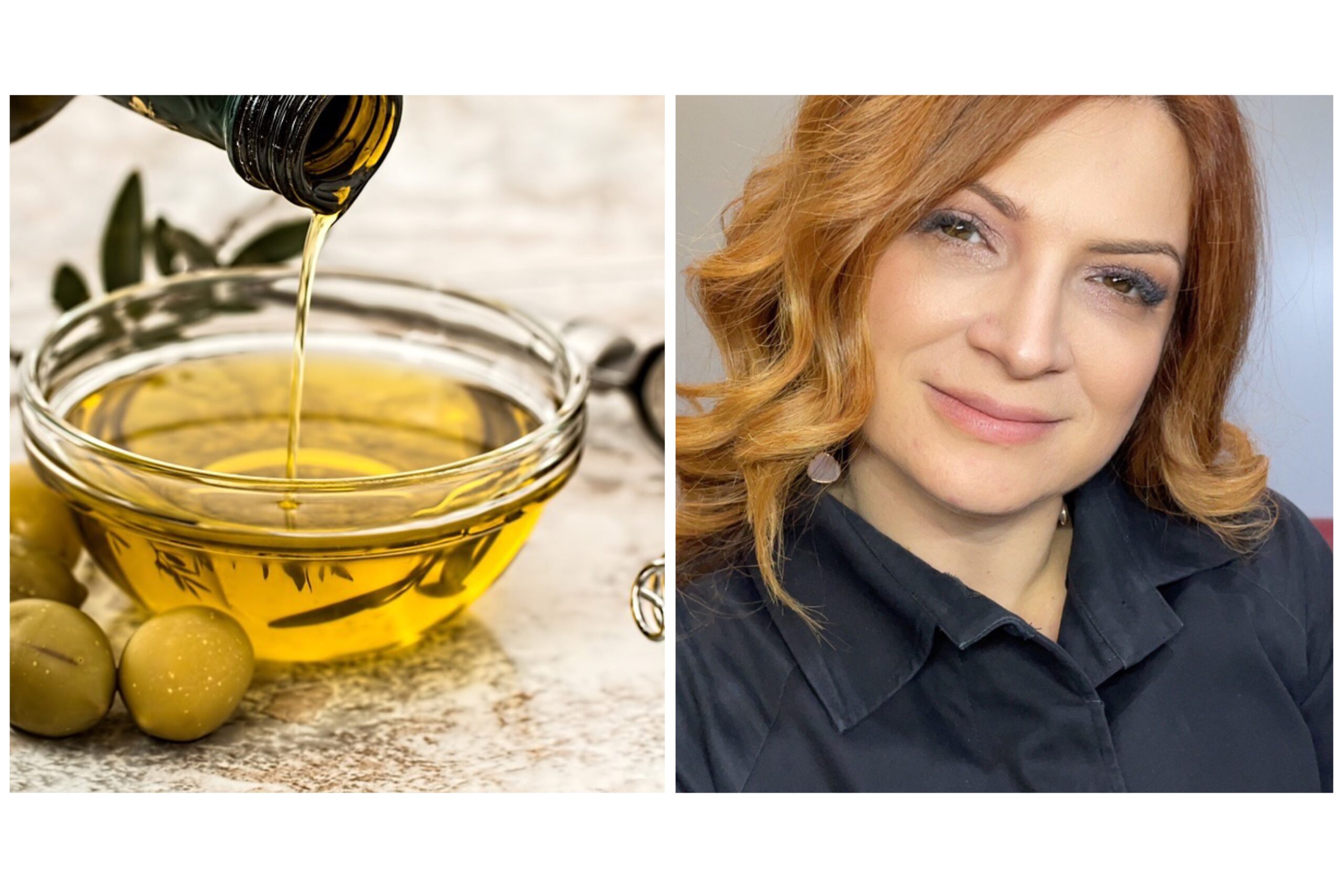 Annalisa Noce, Professore Associato di Nefrologia dell’Università di Roma Tor Vergata